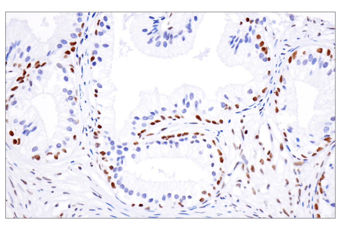 Immunohistochemistry Image 4: Acetyl-Histone H4 (Lys16) (E2B8W) Rabbit mAb