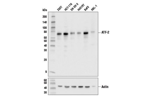 Western Blotting Image 2: ATF-2 (D4L2X) XP<sup>®</sup> Rabbit mAb (BSA and Azide Free)