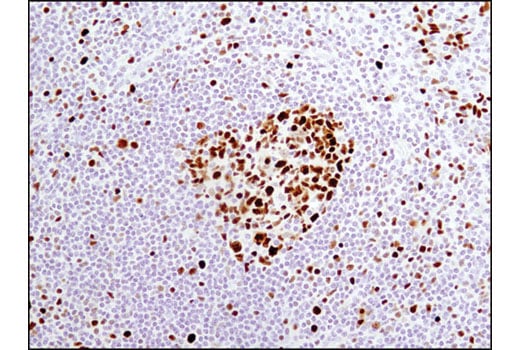 Immunohistochemistry Image 3: MCM4 (D3H6N) XP<sup>®</sup> Rabbit mAb (BSA and Azide Free)