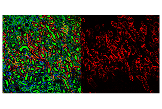 Immunofluorescence Image 3: AQP4 (D1F8E) XP<sup>®</sup> Rabbit mAb (Alexa Fluor<sup>®</sup> 647 Conjugate)