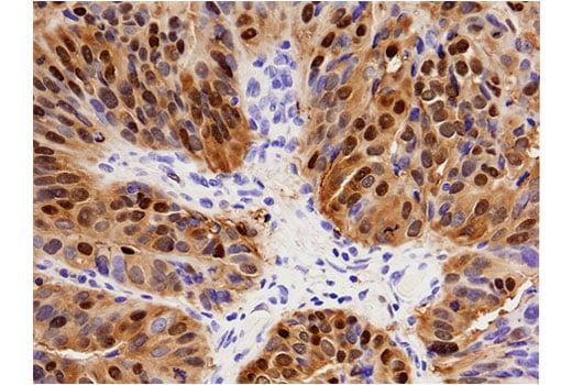 Immunohistochemistry Image 2: Annexin A1 (D5V2T) XP<sup>®</sup> Rabbit mAb (BSA and Azide Free)