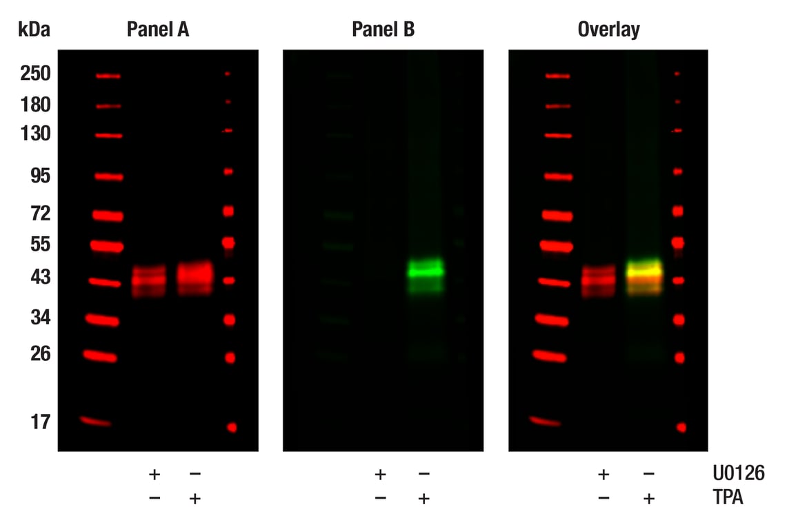 undefined Image 13: ALK Activation Antibody Sampler Kit