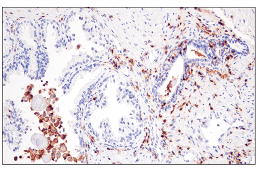 Immunohistochemistry Image 7: CD48 (D7L8I) XP<sup>®</sup> Rabbit mAb (BSA and Azide Free)