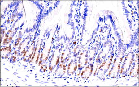 Immunohistochemistry Image 6: ATAD2 (E8Y7F) Rabbit mAb