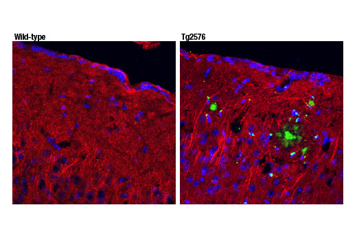 undefined Image 21: β-Amyloid Antibody Sampler Kit
