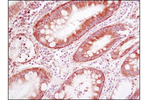 Immunohistochemistry Image 2: YB1 (D2B12) Rabbit mAb