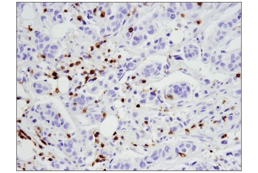 Immunohistochemistry Image 3: CD5 (E8X3S) XP<sup>®</sup> Rabbit mAb (BSA and Azide Free)