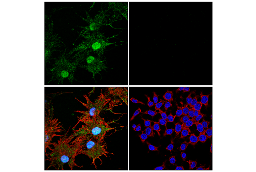 Immunofluorescence Image 1: α-Synuclein (E4U2F) XP<sup>®</sup> Rabbit mAb (BSA and Azide Free)