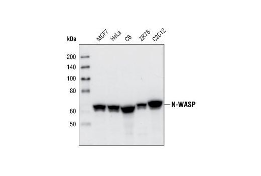 undefined Image 7: Actin Nucleation and Polymerization Antibody Sampler Kit