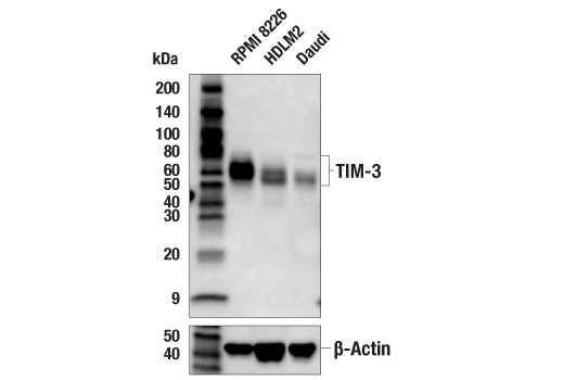 undefined Image 18: Human Exhausted CD8<sup>+</sup> T Cell IHC Antibody Sampler Kit