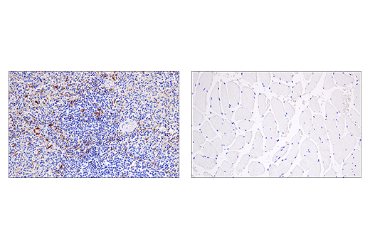 Immunohistochemistry Image 6: Cleaved Gasdermin D (Asp275) (E7H9G) Rabbit mAb (BSA and Azide Free)