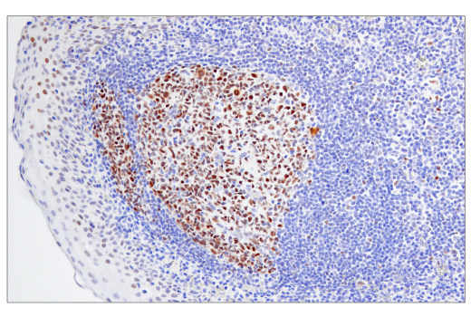 Immunohistochemistry Image 1: BCL6 (E5I8I) Rabbit mAb (BSA and Azide Free)