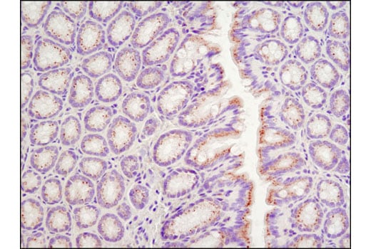 undefined Image 15: Rag and LAMTOR Antibody Sampler Kit