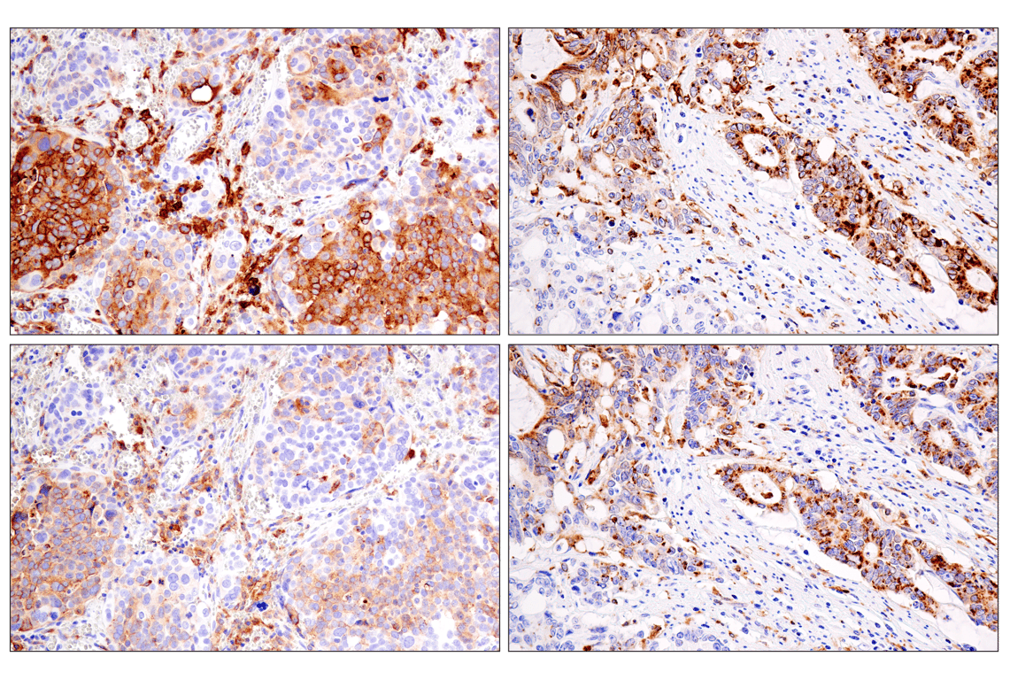 Immunohistochemistry Image 5: HLA-DRA (E9R2Q) XP<sup>®</sup> Rabbit mAb