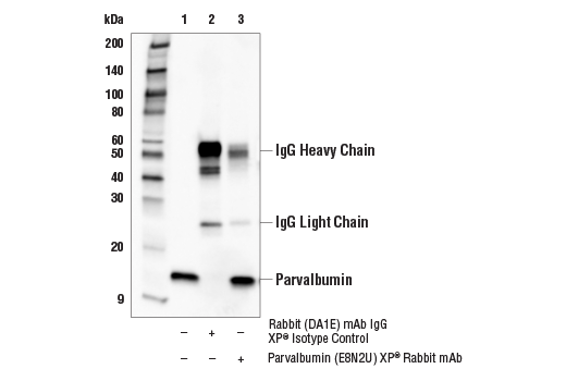Immunoprecipitation Image 1: Parvalbumin (E8N2U) XP<sup>®</sup> Rabbit mAb