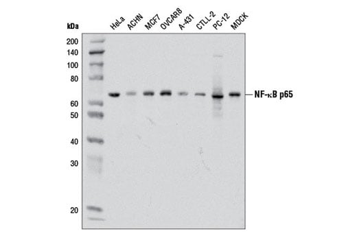 undefined Image 4: PhosphoPlus<sup>®</sup> NF-κB p65/RelA (Ser536) Antibody Duet