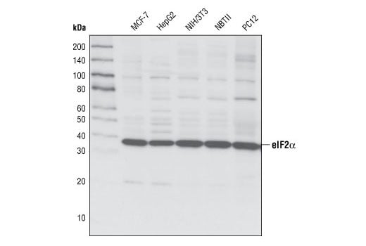 Western Blotting Image 1: eIF2α (L57A5) Mouse mAb