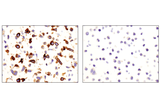 Immunohistochemistry Image 6: CD163 (D6U1J) Rabbit mAb