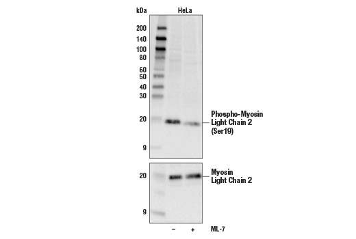 Western Blotting Image 1: Phospho-Myosin Light Chain 2 (Ser19) Mouse mAb