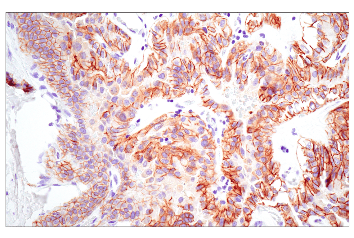 undefined Image 20: Cadherin-Catenin Antibody Sampler Kit