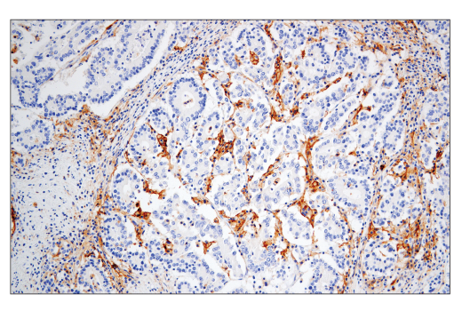 Immunohistochemistry Image 1: CD86 (E2G8P) Rabbit mAb (BSA and Azide Free)