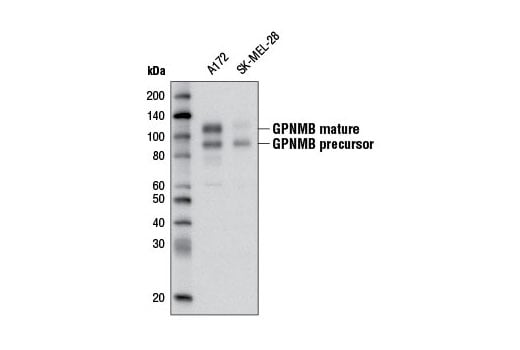 Western Blotting Image 1: GPNMB (E1Y7J) Rabbit mAb