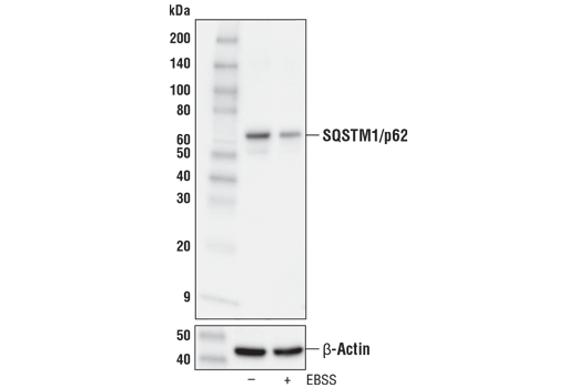 Western Blotting Image 2: SQSTM1/p62 (D1Q5S) Rabbit mAb