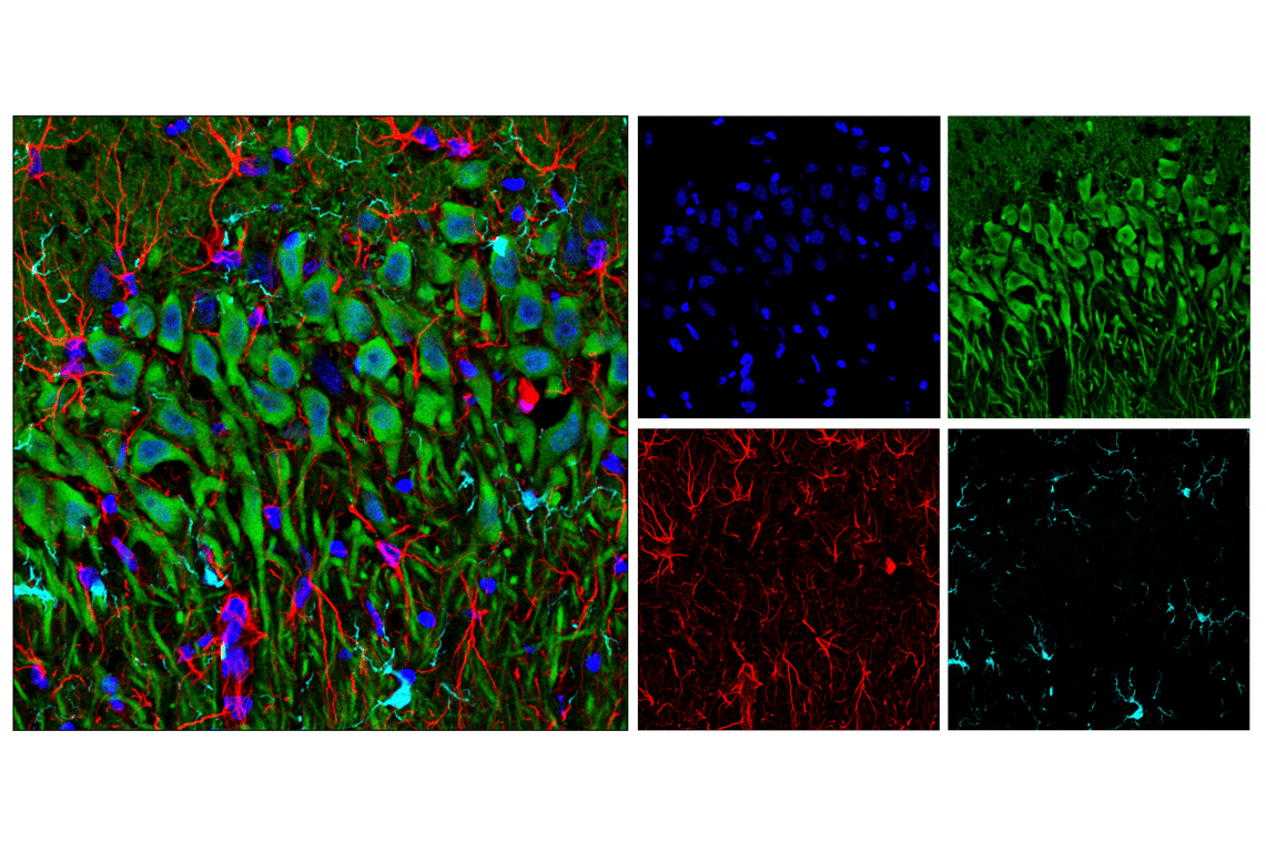Immunofluorescence Image 2: GFAP (E8S7G) Mouse mAb