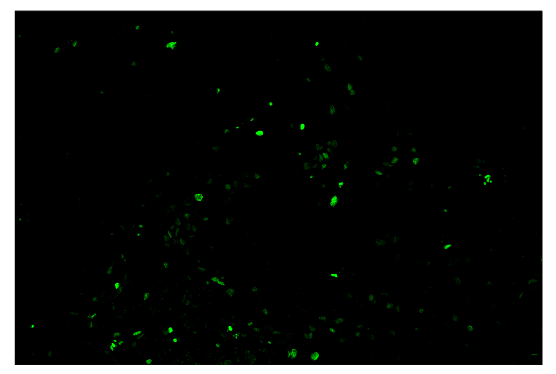 Immunohistochemistry Image 2: Phospho-Histone H2A.X (Ser139) (D7T2V) & CO-0135-647 SignalStar<sup>™</sup> Oligo-Antibody Pair
