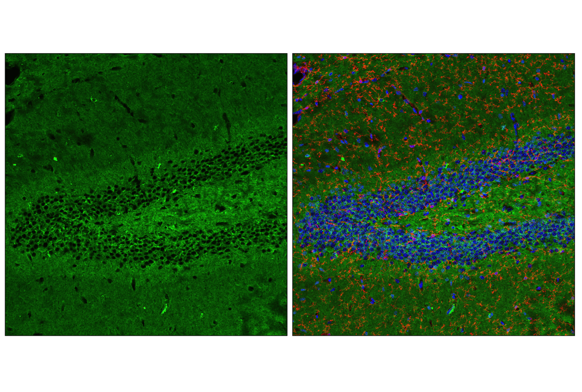 undefined Image 11: LRP1-mediated Endocytosis and Transmission of Tau Antibody Sampler Kit