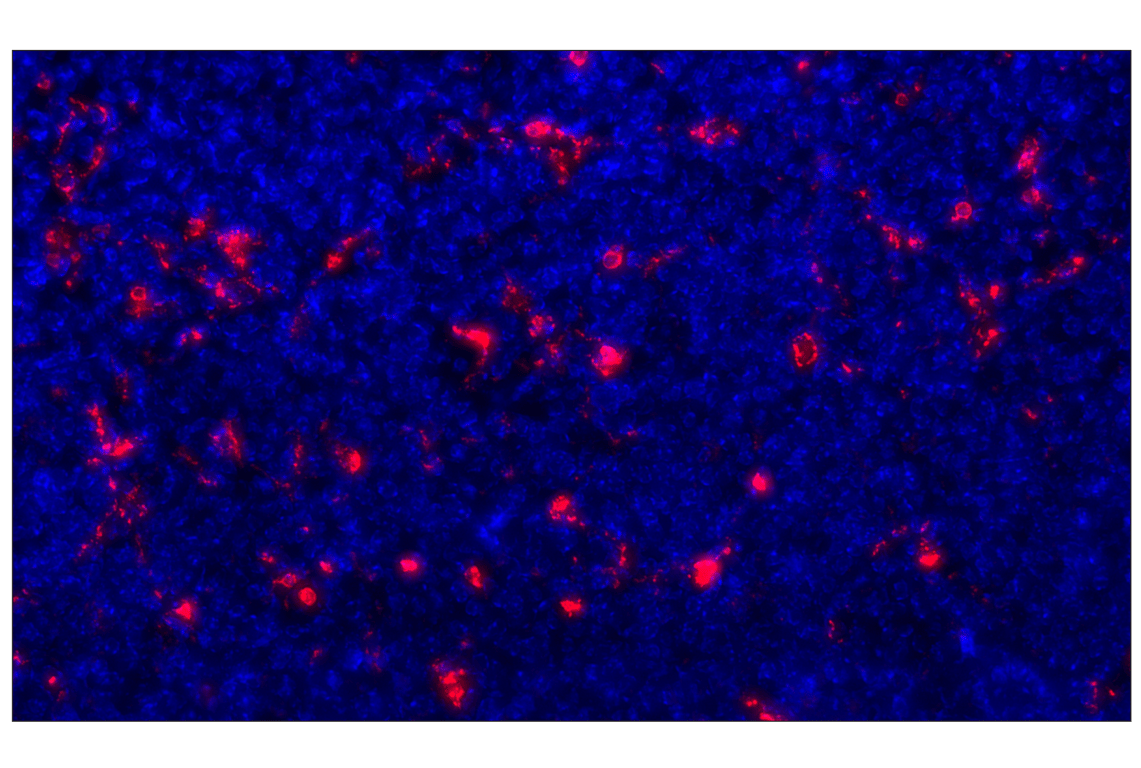 Immunohistochemistry Image 2: CD68 (E3O7V) Rabbit mAb (Alexa Fluor<sup>®</sup> 647 Conjugate)
