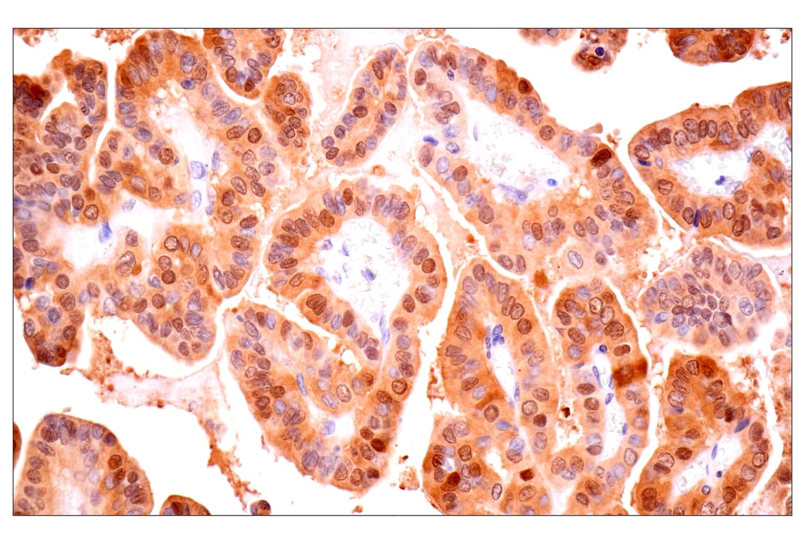 Immunohistochemistry Image 1: ACBP/DBI (E4V8V) XP<sup>®</sup> Rabbit mAb