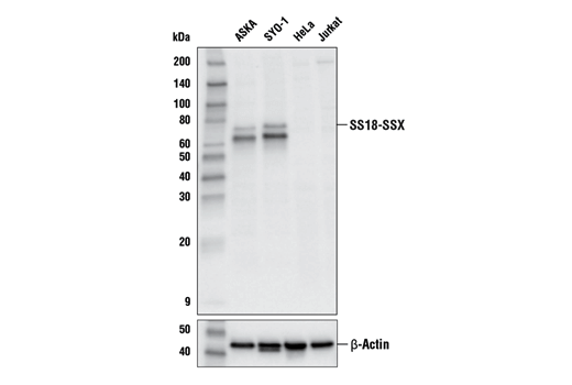 Western Blotting Image 1: SS18-SSX (E9X9V) XP<sup>®</sup> Rabbit mAb (BSA and Azide Free)