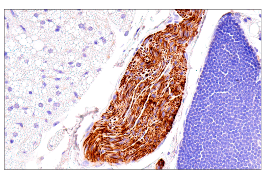 Immunohistochemistry Image 7: Neurofilament-M (E7L2T) Rabbit mAb