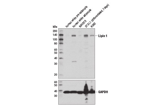 Western Blotting Image 1: Lipin 1 (D2W9G) Rabbit mAb
