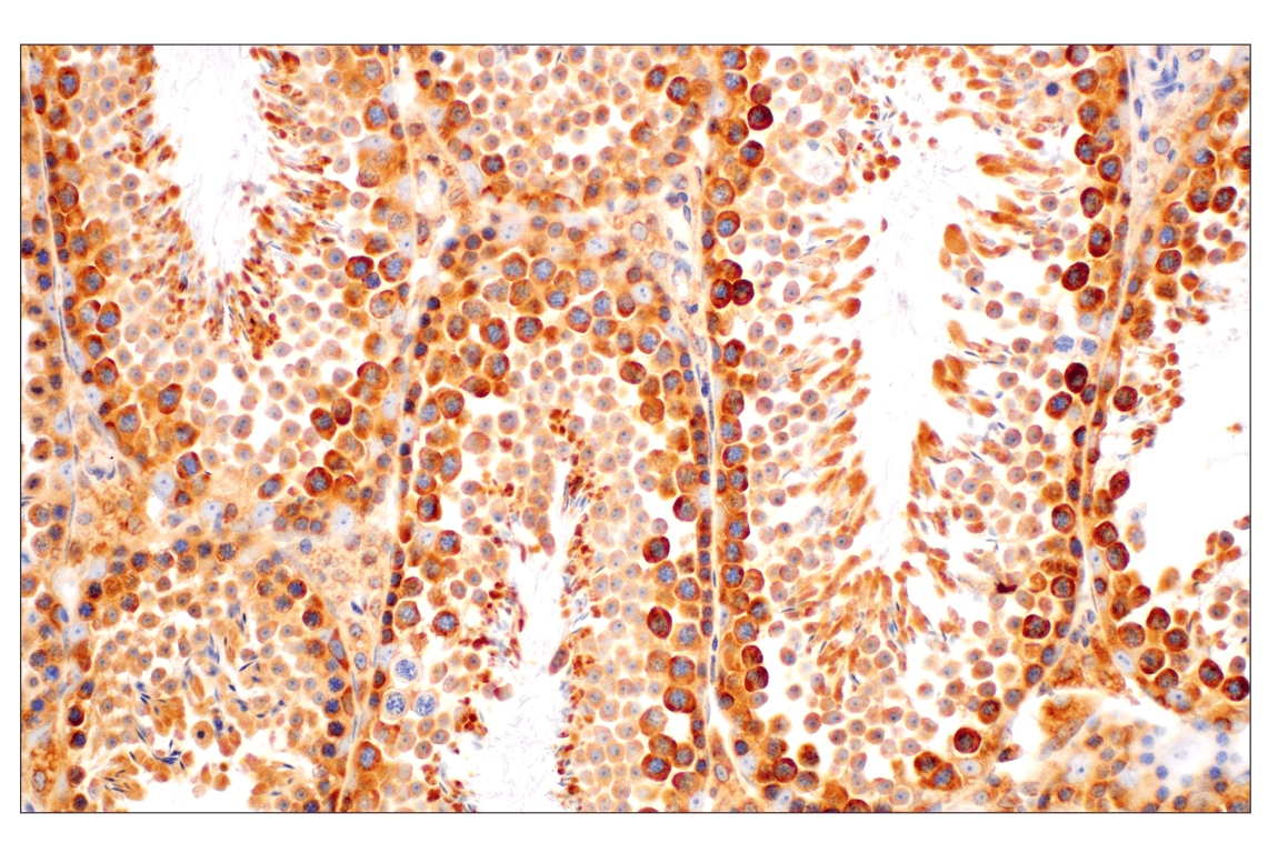 Immunohistochemistry Image 9: RACK1 (D59D5) Rabbit mAb