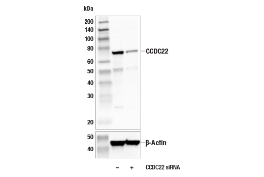 Western Blotting Image 2: CCDC22 (E3F5L) Rabbit mAb
