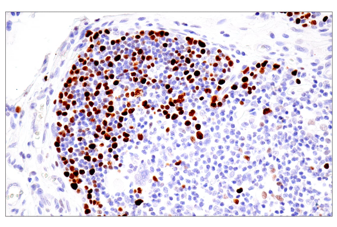 Immunohistochemistry Image 10: UHRF1 (E5W8W) Rabbit mAb