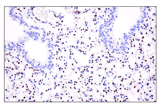 undefined Image 65: Epithelial-Mesenchymal Transition (EMT) IF Antibody Sampler Kit