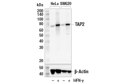undefined Image 6: MHC Class I Antigen Processing and Presentation Antibody Sampler Kit