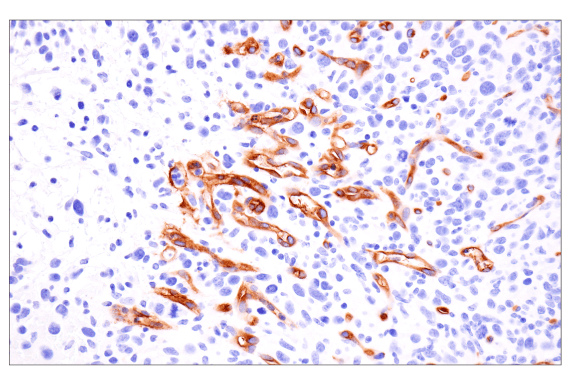 Immunohistochemistry Image 1: ESAM (F9D9P) Rabbit mAb