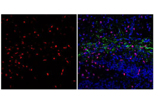 Immunofluorescence Image 1: Olig2 (E6G6Q) XP<sup>®</sup> Rabbit mAb (BSA and Azide Free)