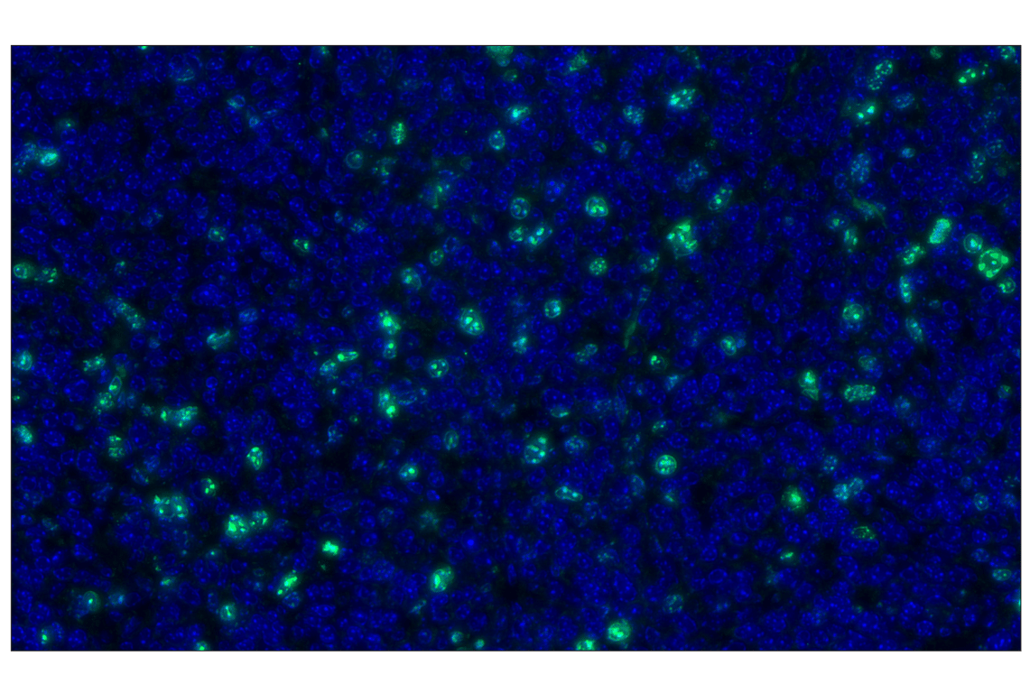 Immunohistochemistry Image 1: Ki-67 (D3B5) Rabbit mAb (Alexa Fluor<sup>®</sup> 488 Conjugate)