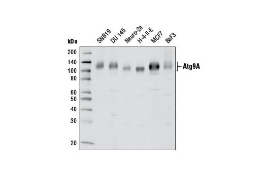 undefined Image 2: Autophagy Vesicle Nucleation Antibody Sampler Kit