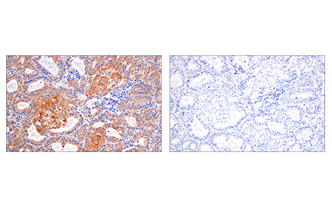 Immunohistochemistry Image 6: RIP (E8S7U) XP<sup>®</sup> Rabbit mAb