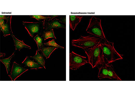 Immunofluorescence Image 1: Glucocorticoid Receptor (D8H2) XP<sup>®</sup> Rabbit mAb (Alexa Fluor<sup>®</sup> 488 Conjugate)