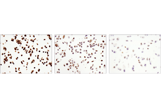 Immunohistochemistry Image 2: DNMT3A (D23G1) Rabbit mAb