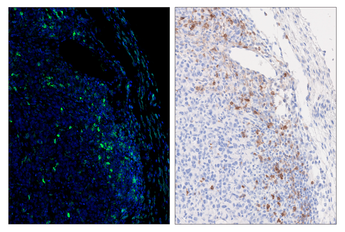 Immunohistochemistry Image 4: OX40 (E9U7O) & CO-0086-488 SignalStar<sup>™</sup> Oligo-Antibody Pair