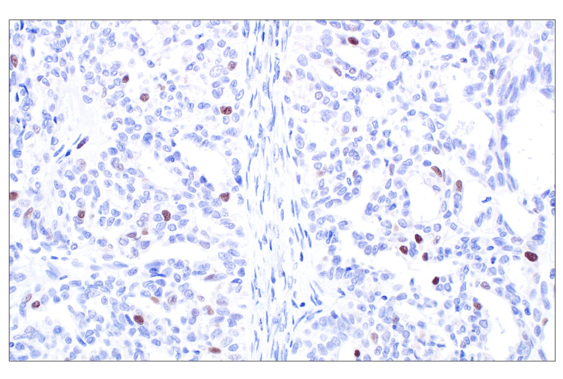 Immunohistochemistry Image 3: MASTL (F7I2C) Rabbit mAb