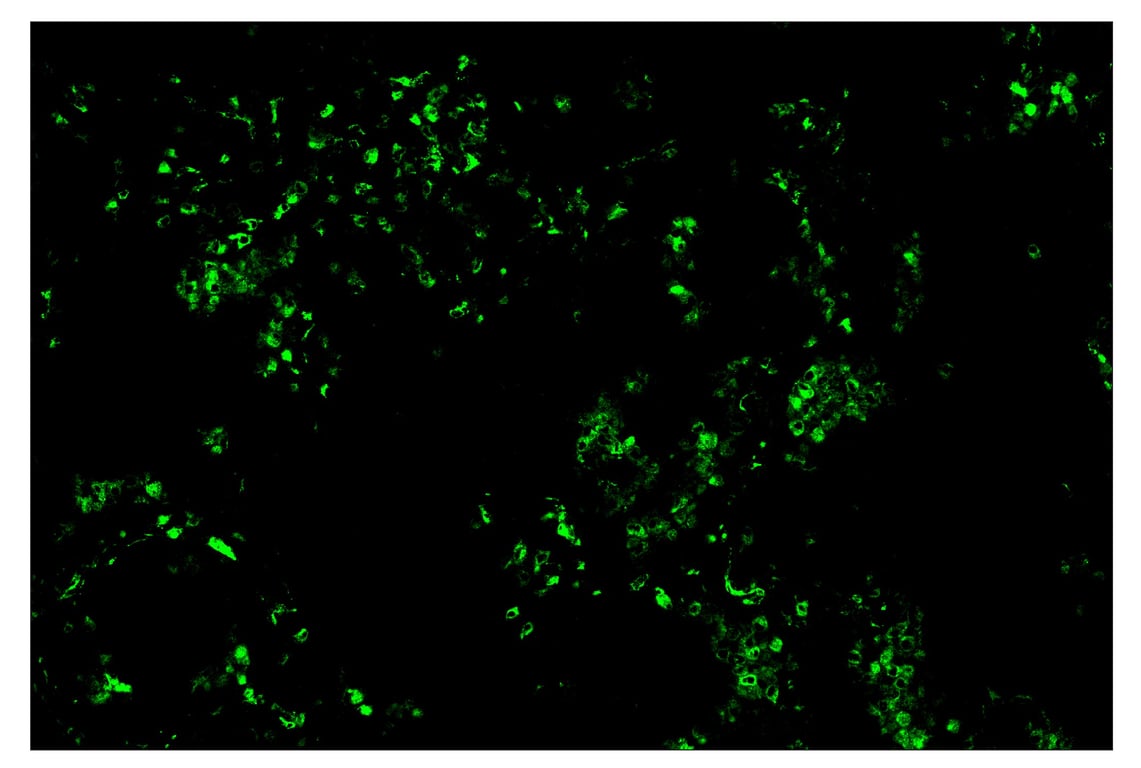 Immunohistochemistry Image 2: CD68 (D4B9C) & CO-0007-594 SignalStar<sup>™</sup> Oligo-Antibody Pair